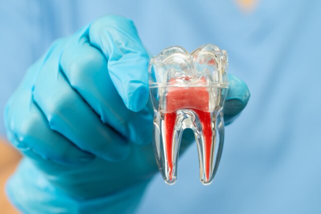 Asian dentist holding dental implant, artificial tooth roots into jaw, root canal