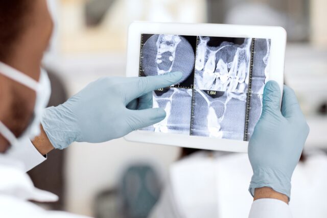 Male Black Dentist Doctor Checking Teeth Xray Picture On Digital Tablet